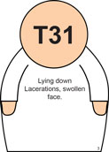 Patienter YDEN T31w